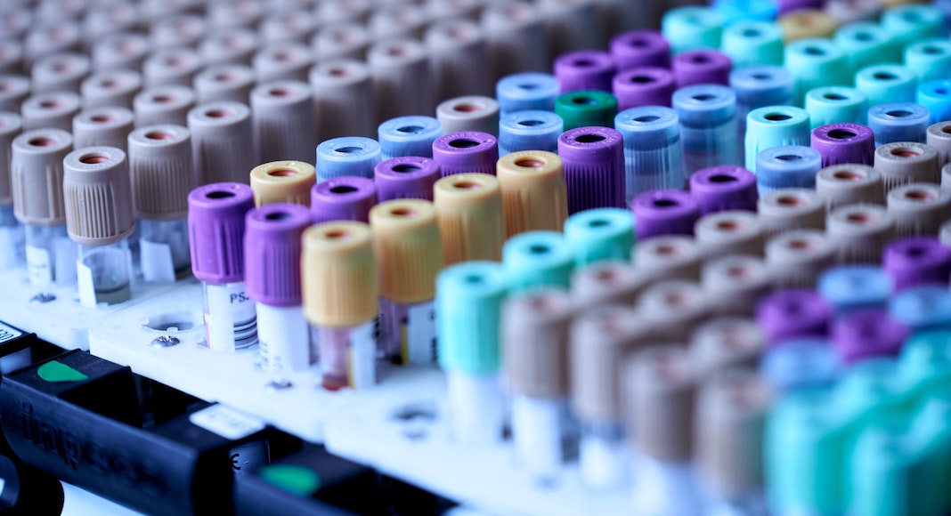 Rows of lab vials